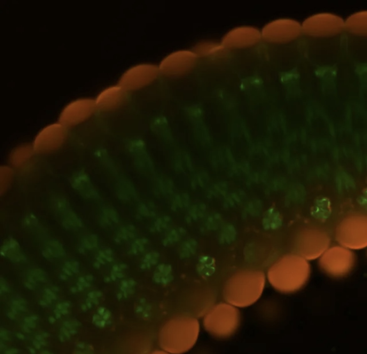 Drosophila Ommatedia and Brain